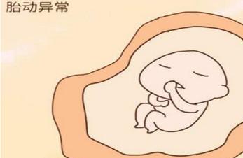 孕期胎儿缺氧了孕妈会收的信号有哪些