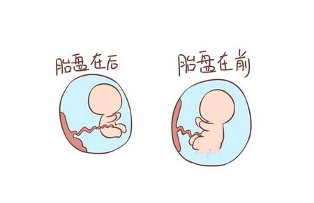 孕期胎盘低置该怎么办