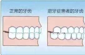 宝宝磨牙怎么办
