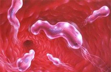 幽门螺旋杆菌阳性是什么意思 幽门阳性是癌症吗？