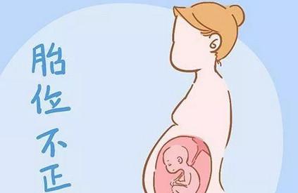 这4种孕妇不适合左侧睡