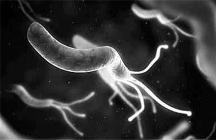幽门螺旋杆菌会引起荨麻疹吗 荨麻疹居然是幽门引起的？