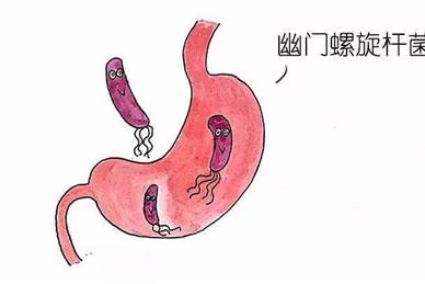 幽门螺旋杆菌可以喝牛奶吗 牛奶会加重病情吗？