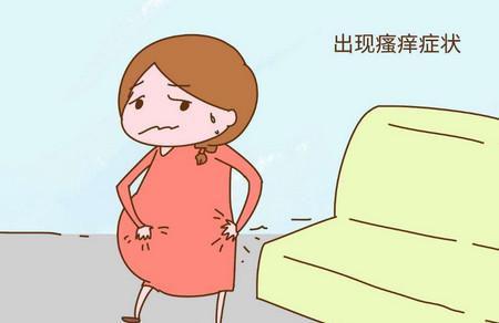 孕期皮肤瘙痒需要注意什么