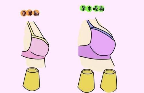 怀孕之后乳房会有哪些变化