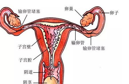 输卵管不通的三种情况