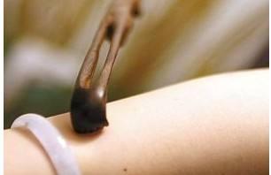 哺乳期过敏怎么办 哺乳期过敏能吃海鲜吗