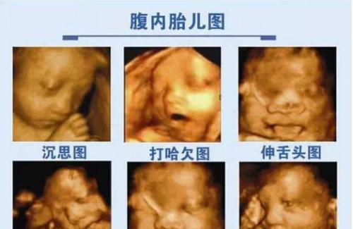 产后胎儿刚出生会做什么