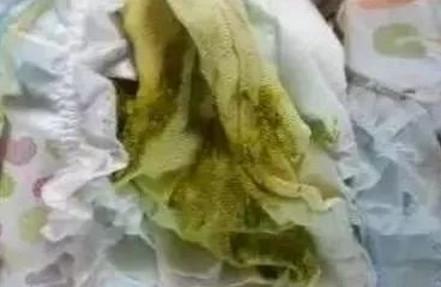 宝宝突然拉绿便的原因有哪些