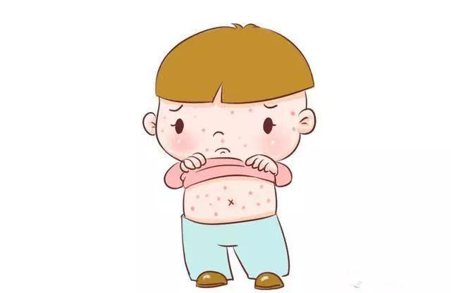 春天宝宝频发疹子怎么办