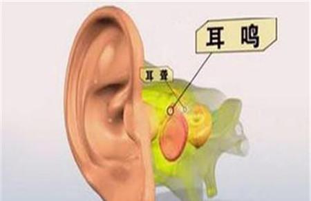 经常熬夜会导致耳鸣吗 哪些原因会引起耳鸣？