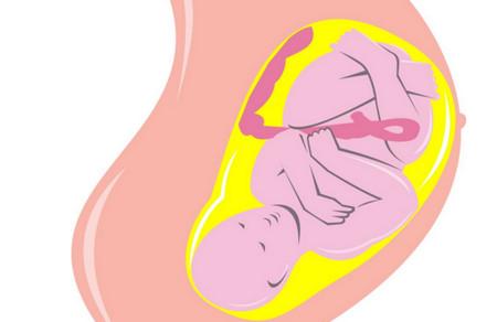 胎儿体位是怎么回事