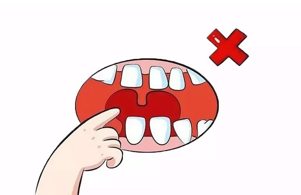 儿童牙齿畸形的危害
