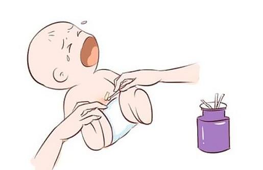 新生儿脐带流水怎么办
