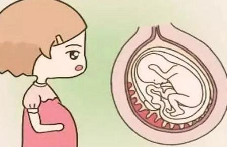 孕期易出现的3种贫血现象