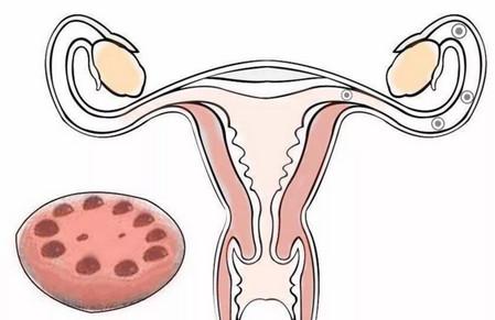阴超显示多囊能怀孕吗