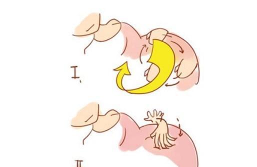 孕妇睡姿不正确胎儿真的会脐带绕颈吗