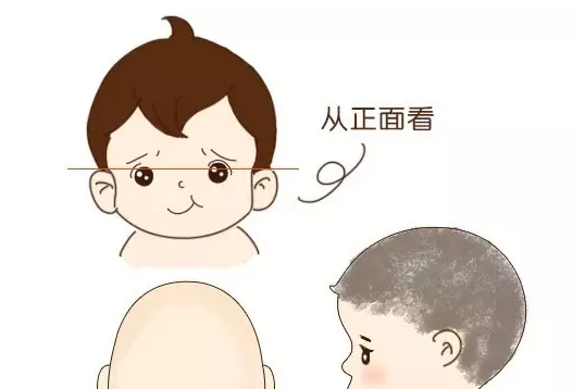 宝宝脸上有白斑是什么怎么回事