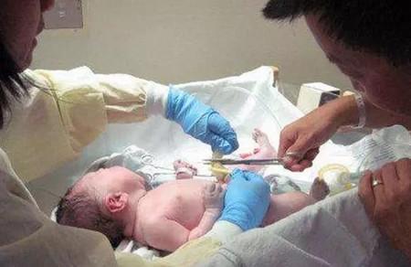 宝宝刚出生的时候医生会做什么