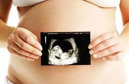 胎儿一到十个月发育图