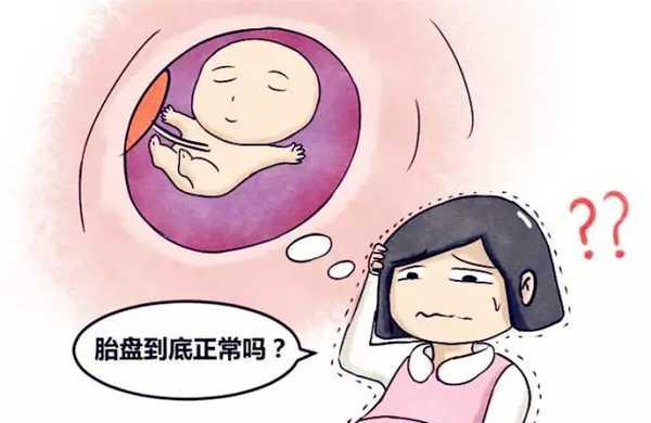 孕期B超检测单要注意哪些事情