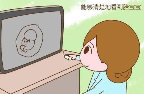 孕期怎么顺利的进行四维彩超