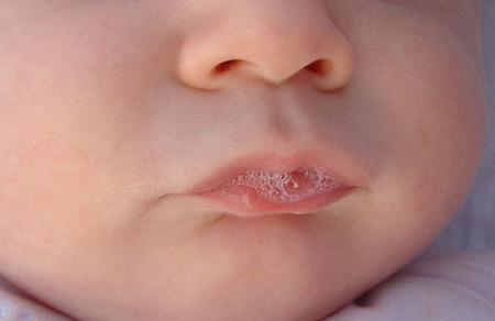 新生儿吐泡泡是肺炎吗?
