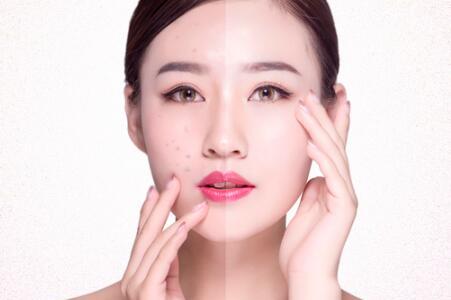 虫牙疼怎么办立刻止疼