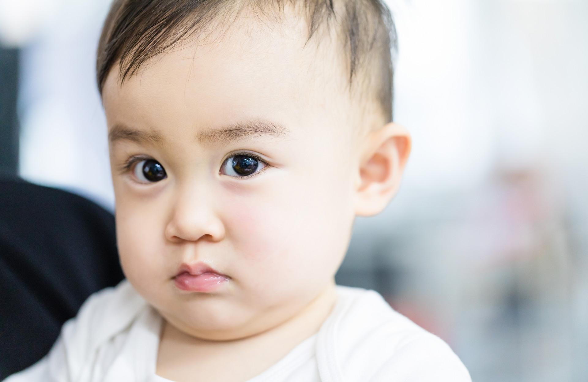 宝宝的湿疹总是复发因为什么