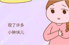乳腺增生肿块怎么治能消 乳房肿块是乳腺增生吗