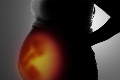 四维彩超脸朝外是男孩女孩