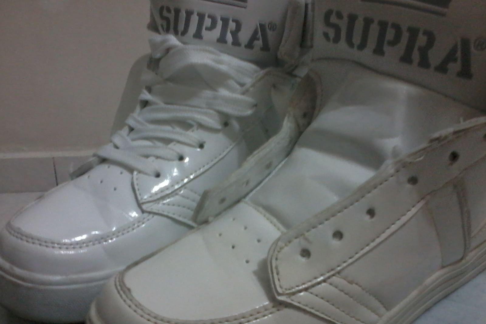 白鞋子发黄有什么办法变白