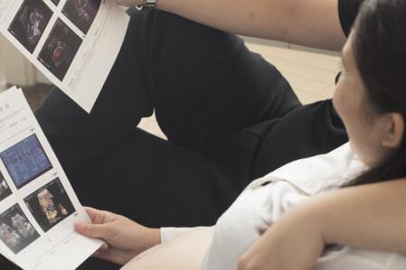 B超单里生男生女的大秘密：医生不说也知道！95%准确率！