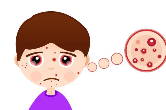 手背上起小疙瘩很痒