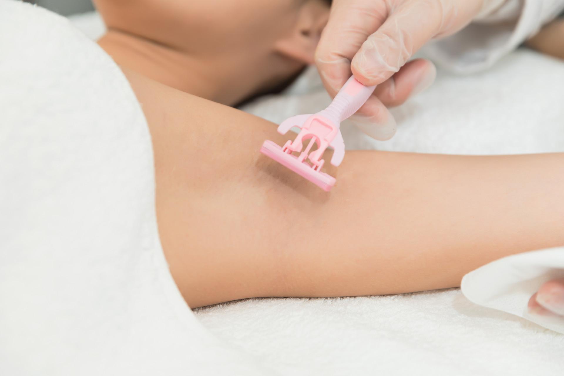 简单有效的绝毛偏方