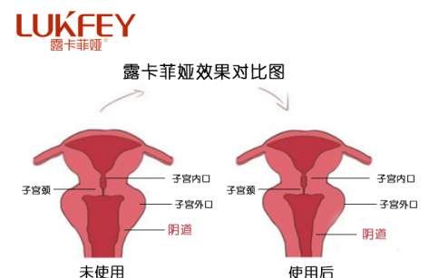缩阴产品到底有用吗？正确认知缩阴产品的重要性！
