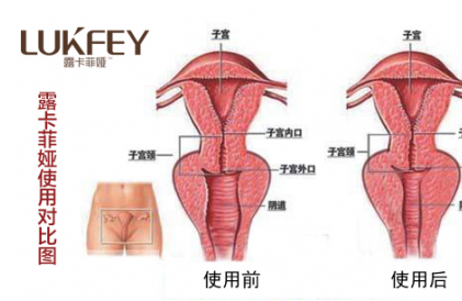 缩阴产品有什么后遗症？这几种产品要当心！
