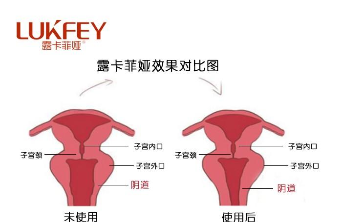 露卡菲娅真的有用吗？效果好自然更受欢迎