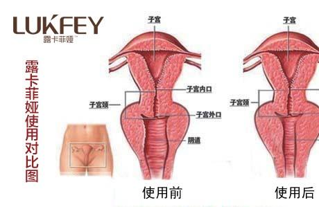 缩阴产品有人用过吗？给没有用过的2句忠告！