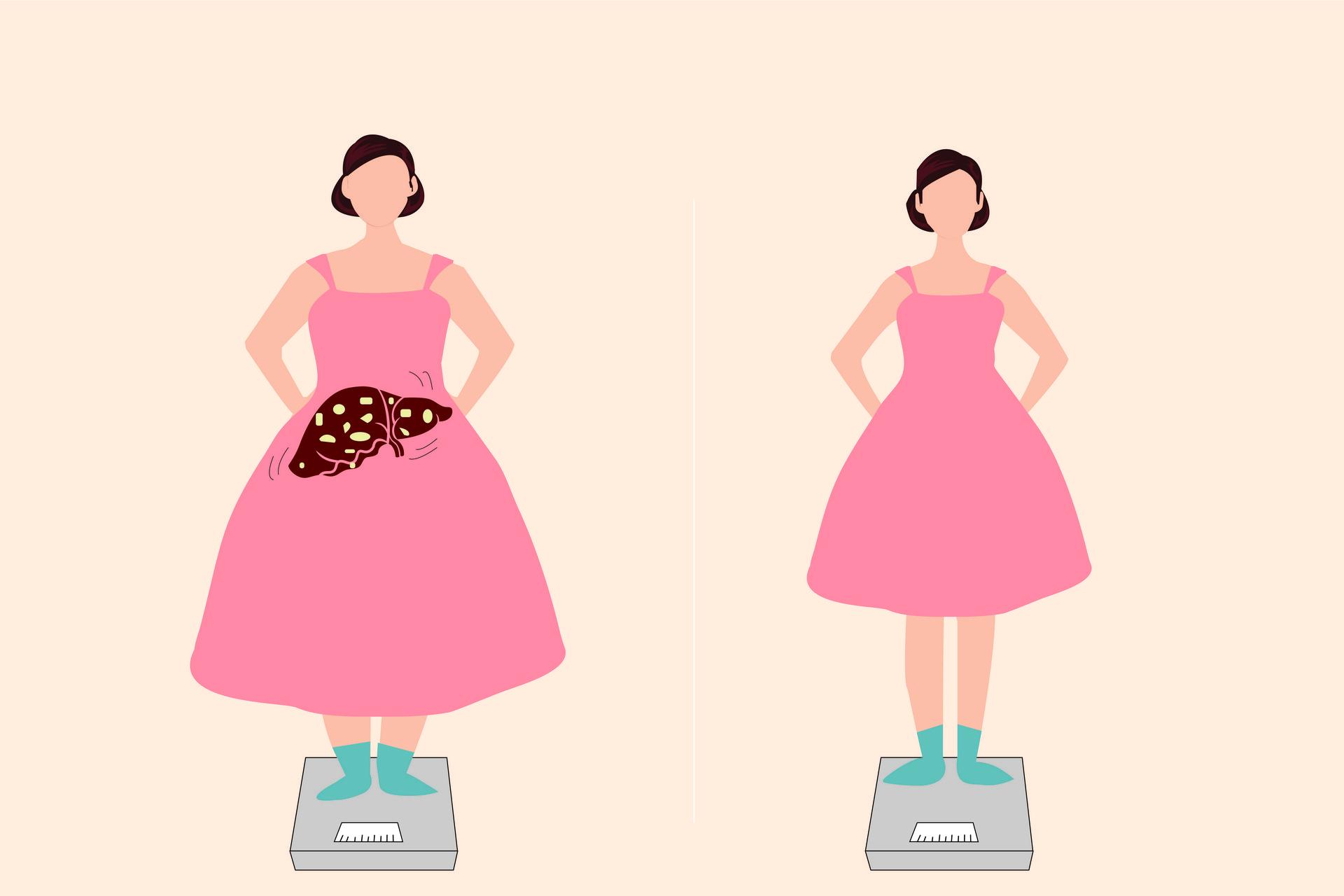 如何判断自己内脏脂肪是不是太多