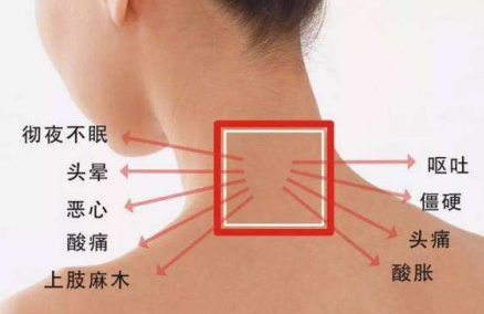 颈椎病早期的10大症状你造吗？知晓颈椎病有哪些症状