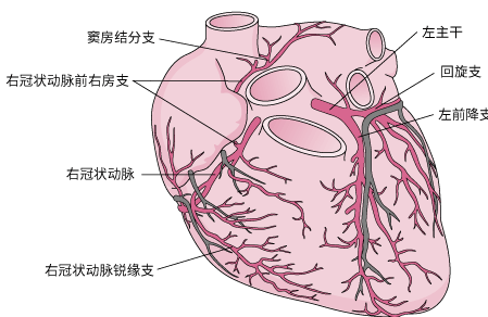 心绞痛是什么原因引起的？心绞痛怎样治疗瞄准斑块