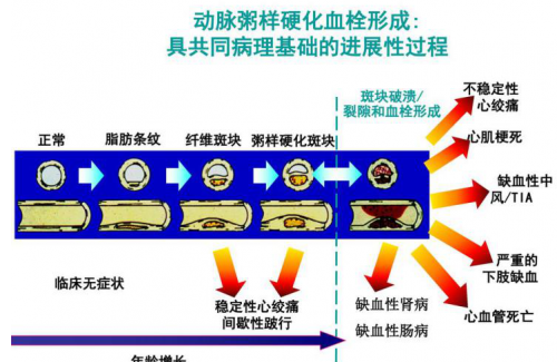 胸口疼是怎么回事？胸疼是怎么回事啊？这下全明白了