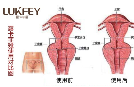 缩阴产品可以使用吗？牢记3点放心用！