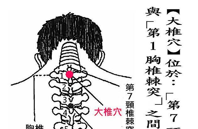 大椎的准确位置图和作用