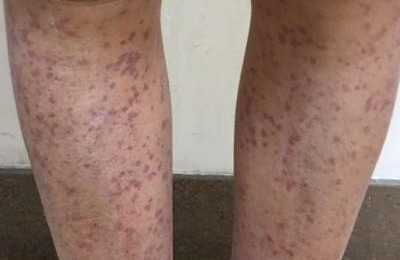 郑州西京医院好不好？人文医疗开启特色服务