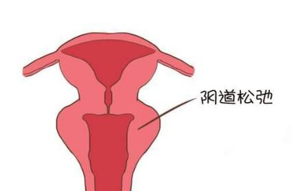 什么牌子的缩阴产品效果好，用这款产品真紧了！