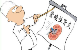 贵州贵阳去哪里治疗紫癜好？成都银康紫癜医院找胡海彦医生
