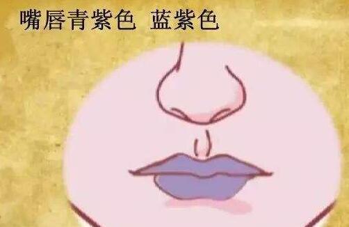 嘴唇发紫跟宫寒有关系吗 宫寒嘴唇发紫怎么治疗
