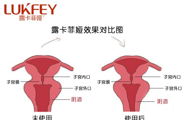 缩阴效果比较好的产品，这款产品用完就紧了！